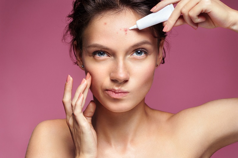 Forehead Acne: What Are The Causes And Treatment?
