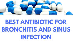 What is the Best Antibiotic for Sinus Infection?