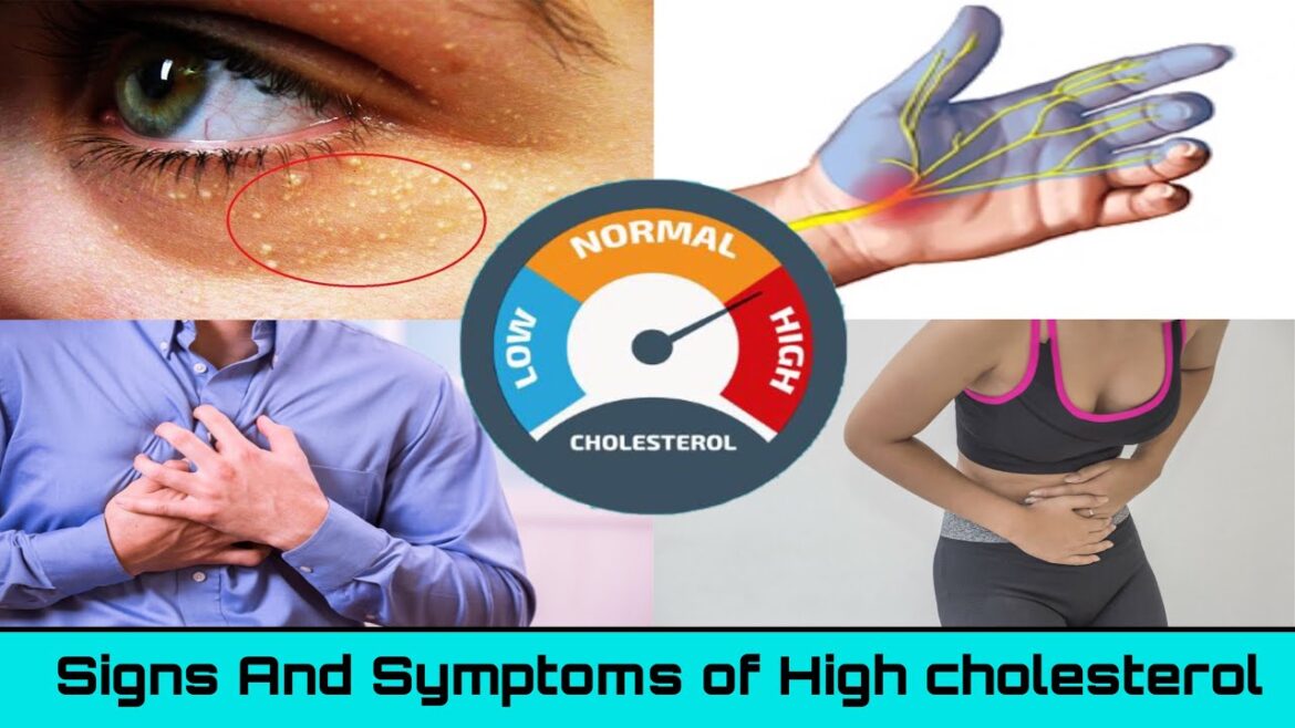 Read This To Know Symptoms Of High Cholesterol